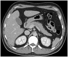 Abdominal CT scan2 CT scans of the abdomen